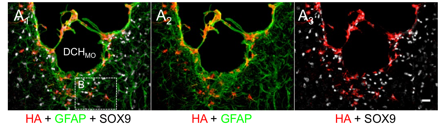 MOXhydrogel2.png